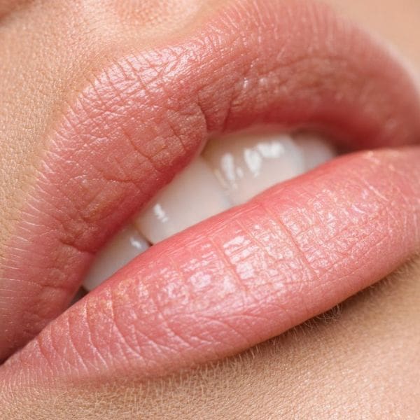Ácido Hialurónico para hidratar los labios