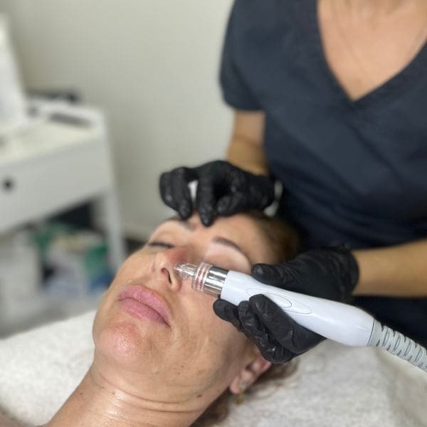 Limpieza profunda hydrafacial