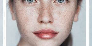 Relleno de Labios conoce la técnica