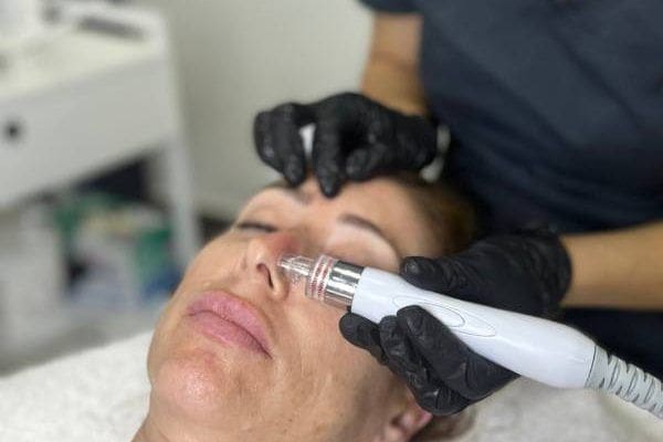 limpieza hydrafacial