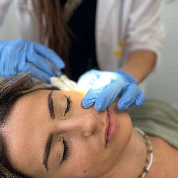 mesoterapia facial