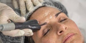 RADIOFRECUENCIA FACIAL