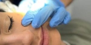 mesoterapia facial
