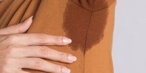 Hiperhidrosis Sudoración excesiva