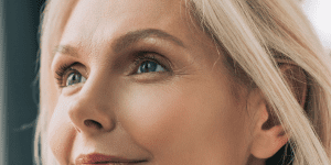 flacidez facial tratamiento